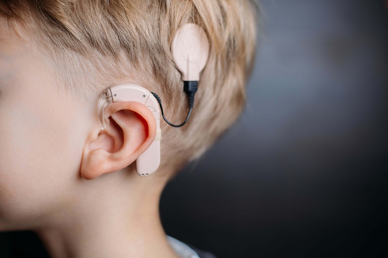 Find Your Cochlear Implant Class Action Lawsuit: Top Tips